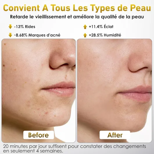 Masque LED Visage Et Cou, Ntyikul LED Visage avec 7 Couleurs de Lumière et 5 Niveaux de Luminosité, LED Mask avec Télécommande, pour Tous Types de Peau, pour Anti-Age, Illumine Le Teint