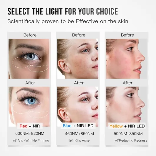 Masque Facial LED de Visage Luminothérapie, Thérapie par la Lumière Rouge Anti-Âge, 3 Couleurs, Raffermissant, Éclaircissement, Beauté pour Tous Les Types de Peau à la Maison, (Blanc)