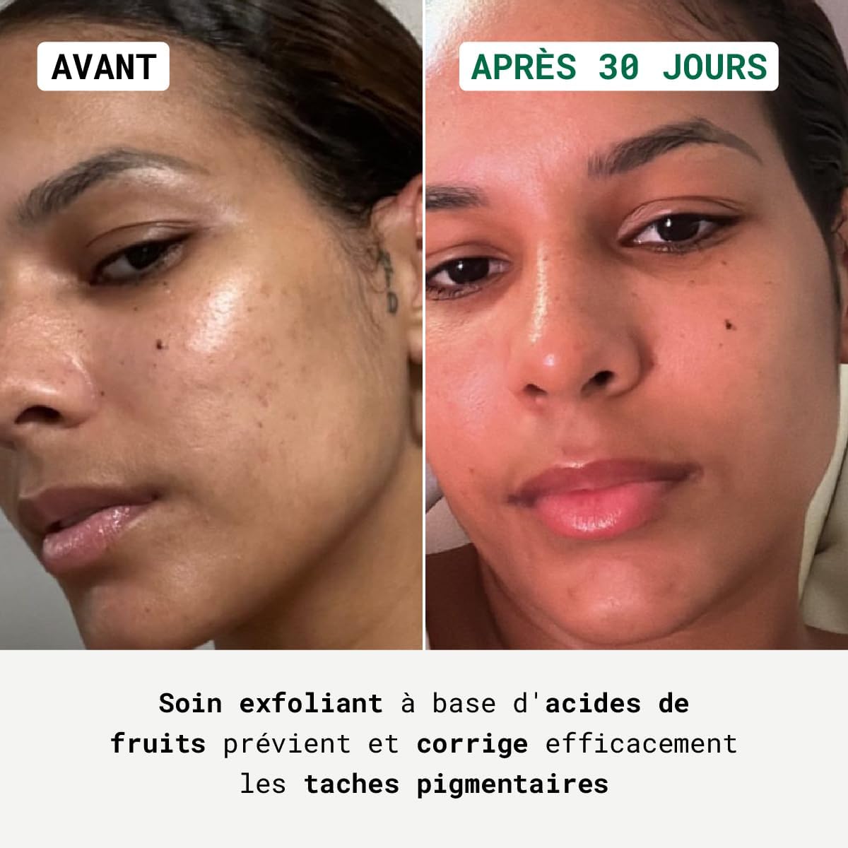 Sérum Éclat - Crème Anti-Taches pour Visage, Exfoliant Unifiant pour Peaux Noires, Mates et Métissées, Homme et Femme - 30ml