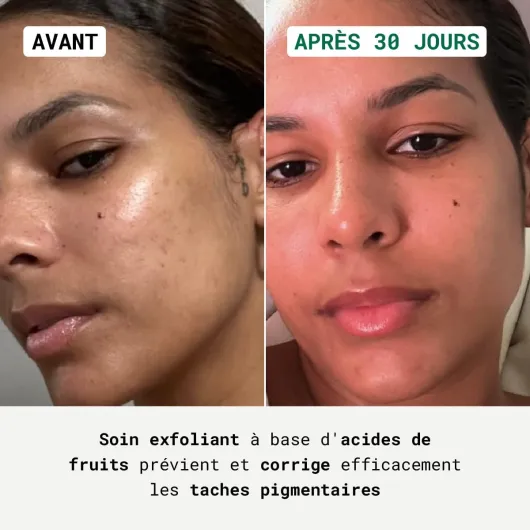 Sérum Éclat - Crème Anti-Taches pour Visage, Exfoliant Unifiant pour Peaux Noires, Mates et Métissées, Homme et Femme - 30ml